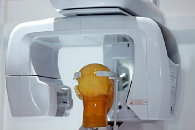 Dental Scanner